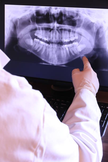 Best Knocked-Out Tooth (Avulsed Tooth) Treatment in Heber, UT